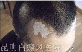 糣ʶʶ