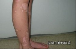 ļ¶԰综ЩΣ