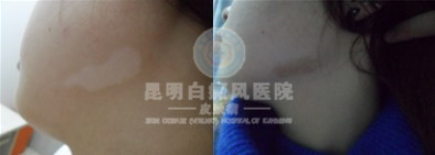 沿Ч
