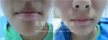 沿֢״Щ