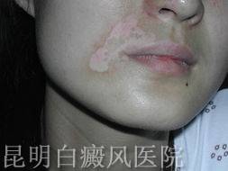 综ʱҪעʲô
